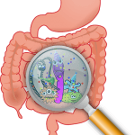 gastritis bacterias en el estómago